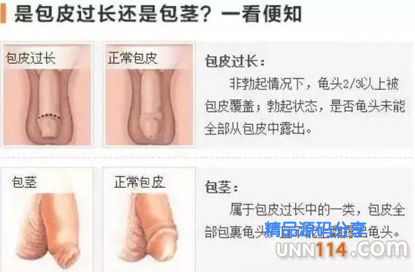 昌吉怎么才算包皮过长