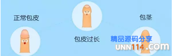 昌吉温宿县怎么区分是包皮过长还是包茎？