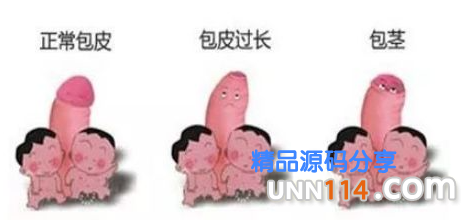 昌吉沙雅县包皮过长是怎样困扰男性朋友的呢